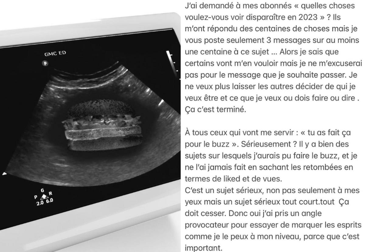 Une influenceuse française s'invente une grossesse et crée le malaise
