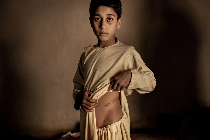 This image provided by World Press Photo is part of a series titled The Price of Peace in Afghanistan which won the World Press Photo Stories award by photographer Mads Nissen, Politiken / Panos Pictu ...