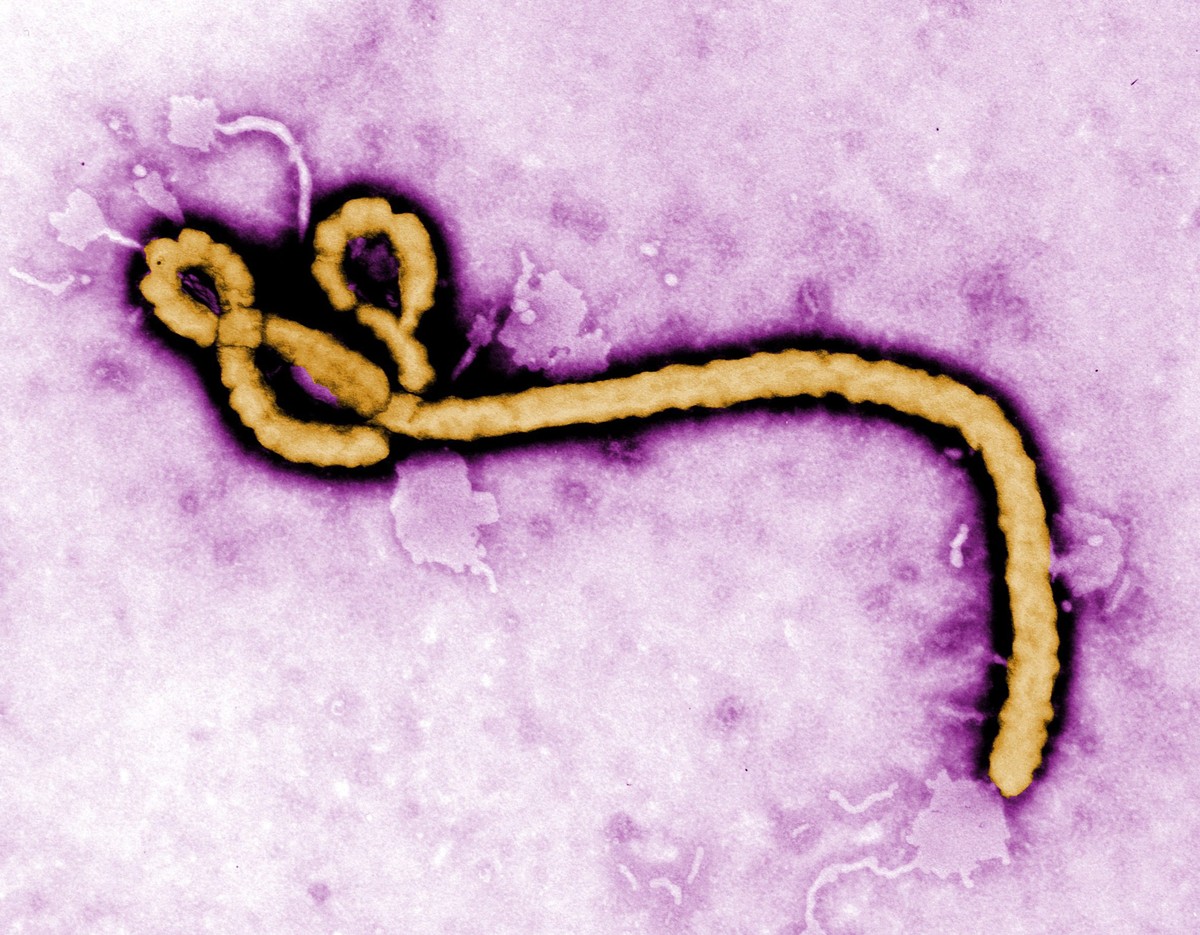 So sieht das Virus aus.