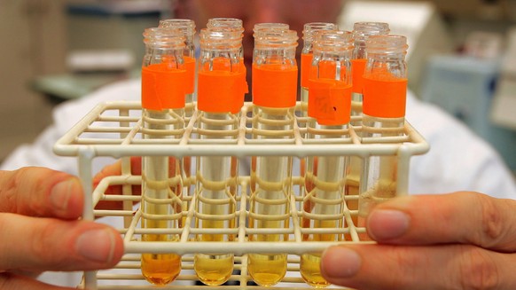 epa05018131 (FILE) A file picture dated 08 August 2004 shows urine samples prepared for testing on the blood-booster EPO in the Swiss Laboratory for Analysis of Doping (LAD) in Lausanne, Switzerland.  ...