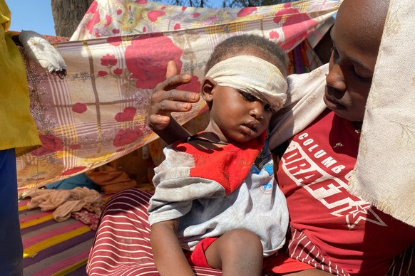 KEYPIX - A Sudanese child who fled el-Fasher city with family after Sudan&#039;s paramilitary forces killed hundreds of people in the western Darfur region, receives treatment at a camp in Tawila, Sud ...