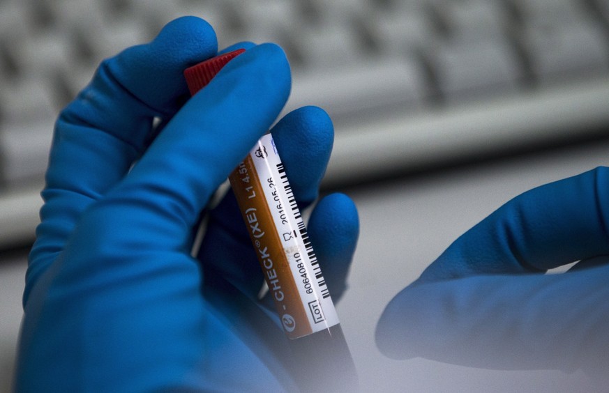 Riesige Doping-Razzia: 234 Verdächtige in 33 Ländern festgenommen – auch in der Schweiz