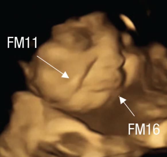 The fetus of a pregnant woman who previously ate kale makes a crying face.