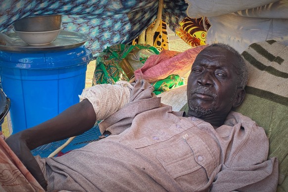 An injured Sudanese man who fled el-Fasher city, after Sudan&#039;s paramilitary forces killed hundreds of people in the western Darfur region, rsits in a tent at a camp in Tawila, Sudan, Saturday, No ...