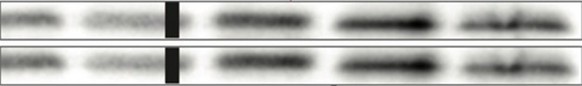 In Lesné’s 2006 Nature paper on Aβ*56, these western blot bands ostensibly represent two different control proteins, but instead are exact duplicates of each other.