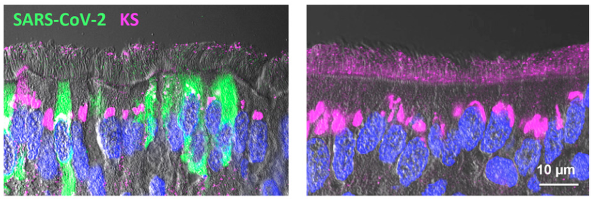 Fotos der Corona-Studie: "SARS-CoV-2 infection of airway cells causes intense viral and cell shedding, two spreading mechanisms affected by IL-13"