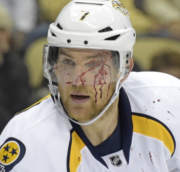 Blood trickles down the face of Nashville Predators defenseman Yannick Weber after he was struck in the face by the puck during the second period of the team&#039;s NHL hockey game against the Pittsbu ...