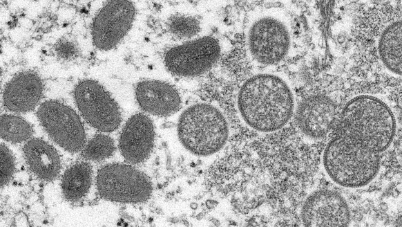 FILE - This 2003 electron microscope image made available by the Centers for Disease Control and Prevention shows mature, oval-shaped monkeypox virions, left, and spherical immature virions, right, ob ...