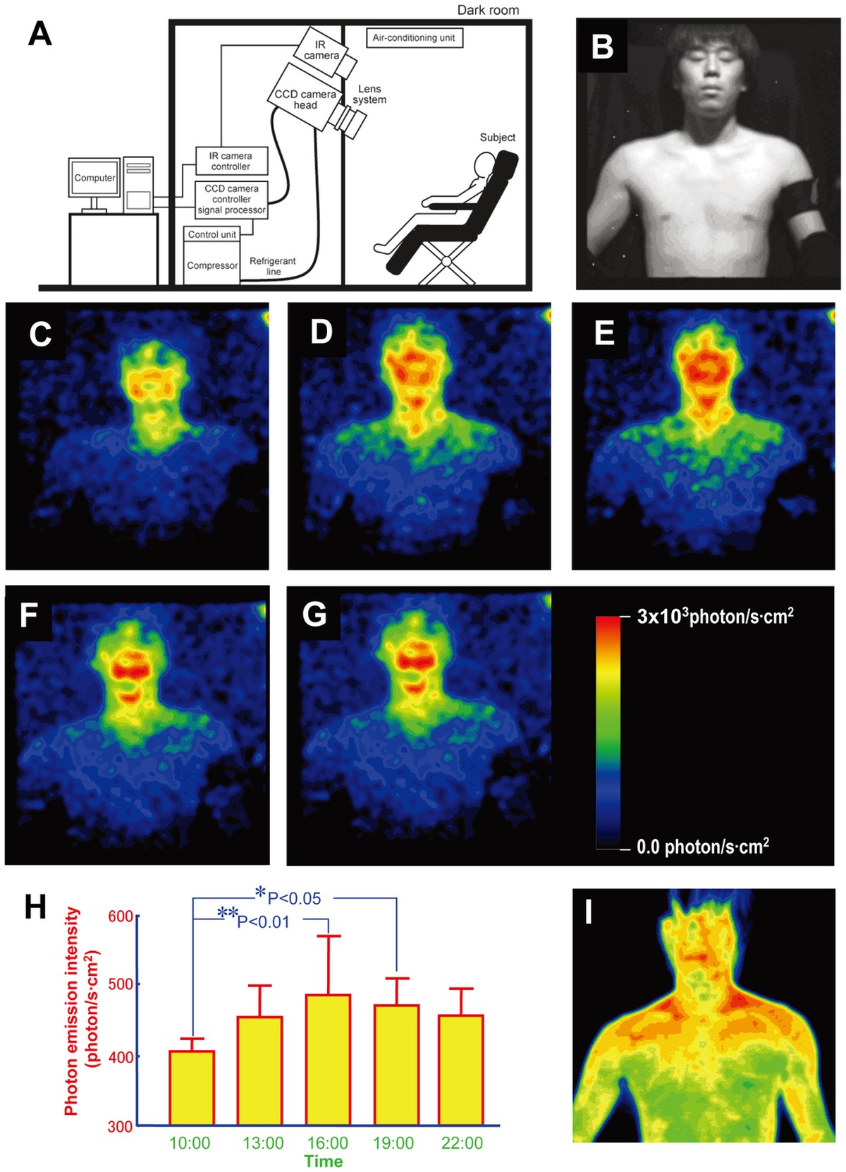 A. Schematic illustration of experimental setup. B–F. Images of ultraweak photon emission from human body. B. Image of the subject under light illumination. C. Image at 10:10. D. Image at 13:10. E. Im ...