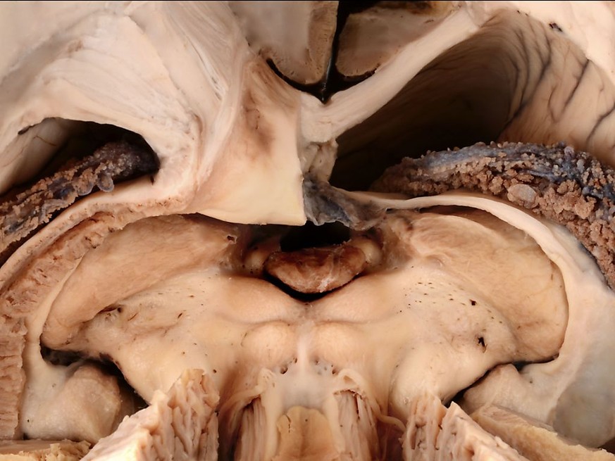 Diese Perspektive aufs Gehirn bekommen sonst nur Hirnchirurginnen und -chirurgen zu sehen. Das Siegerbild der Kategorie &quot;Forschungsobjekt&quot; entstand allerdings im Zuge einer anatomischen Stud ...