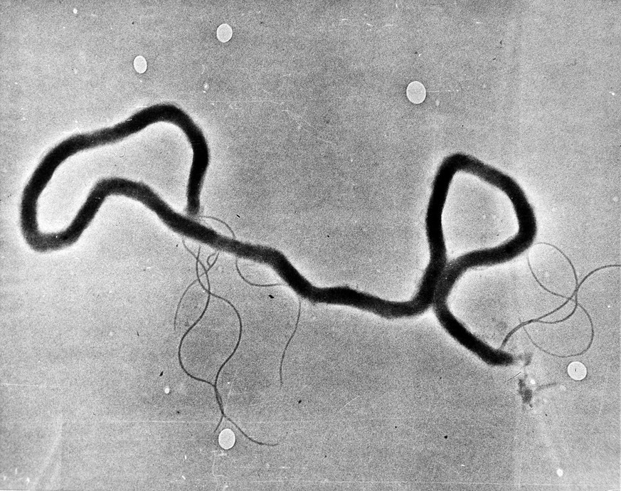 FILE - In this May 23, 1944 file photo, the organism treponema pallidum, which causes syphilis, is seen through an electron microscope. Las Vegas is experiencing a syphilis outbreak, as health officia ...