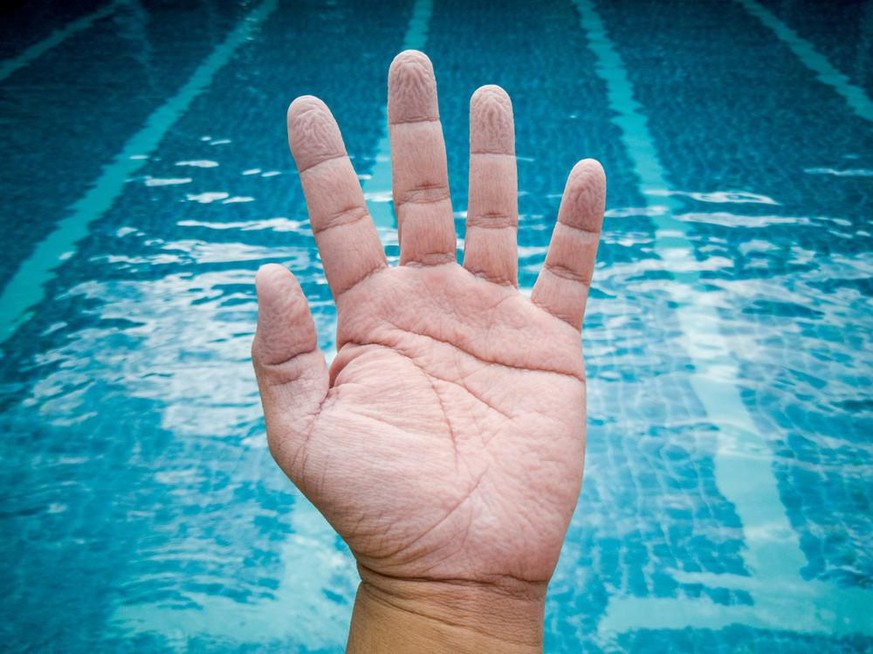 schrumplige Finger nach längerem Kontakt mit Wasser