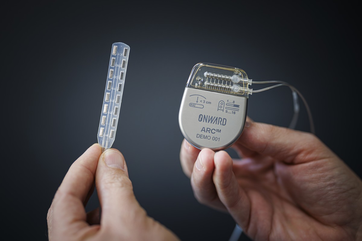 Une électrode et un émetteur: tout le savoir-faire d'Onward dans ce petit boîtier.