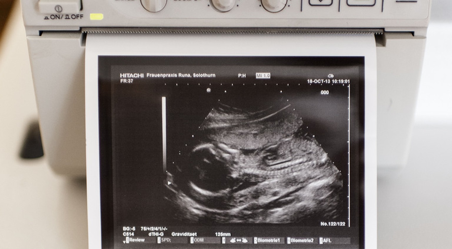 Ein 20 Wochen altes Embryo.