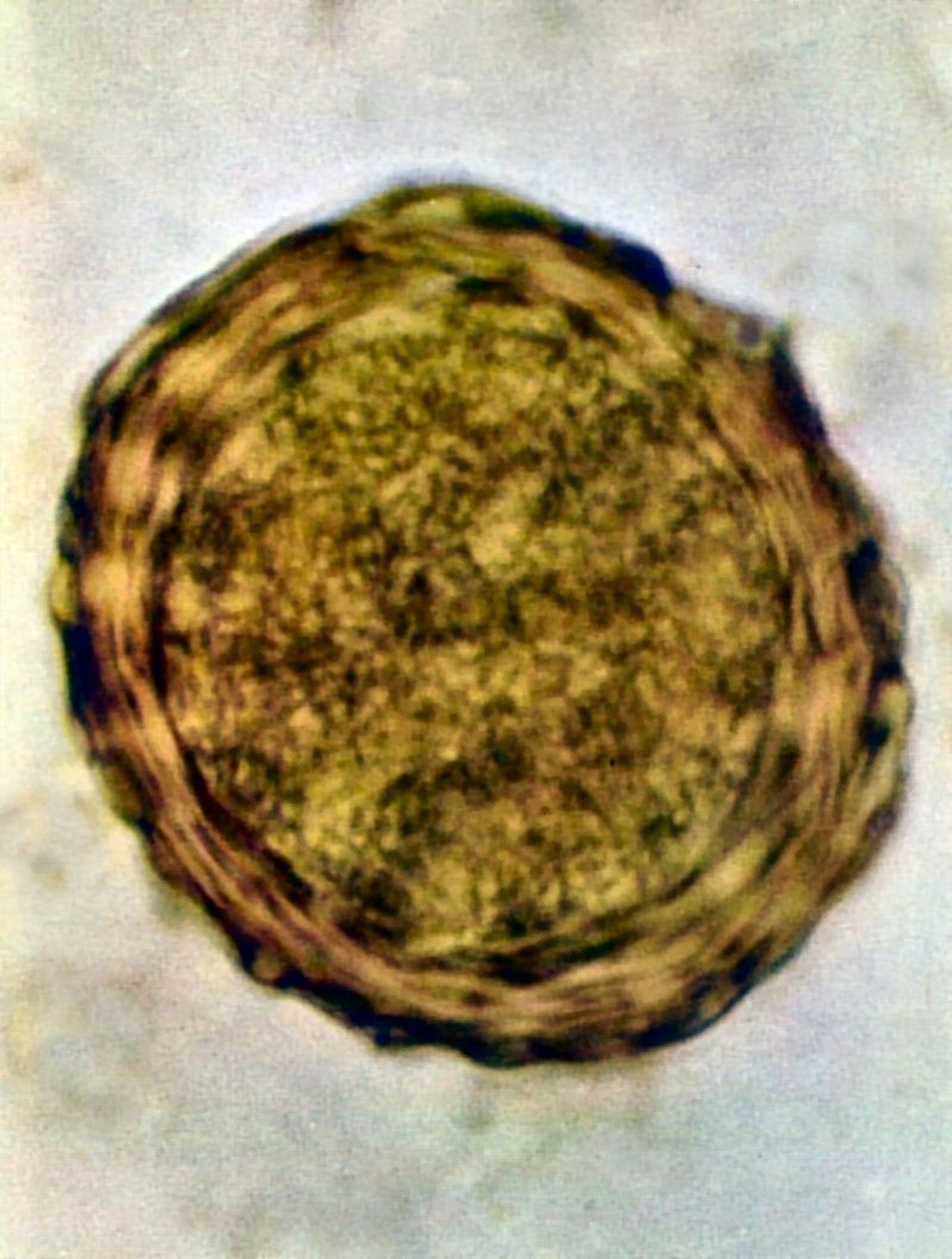 Ei des Riesenspulwurms Ascaris lumbricoides in menschlichem Stuhl.
https://commons.wikimedia.org/w/index.php?curid=10915815