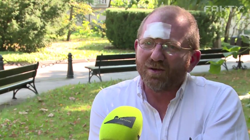 Historiker Jerzy Kochanowski zeigt sich im polnischen Fernsehen mit Wunde am Kopf.