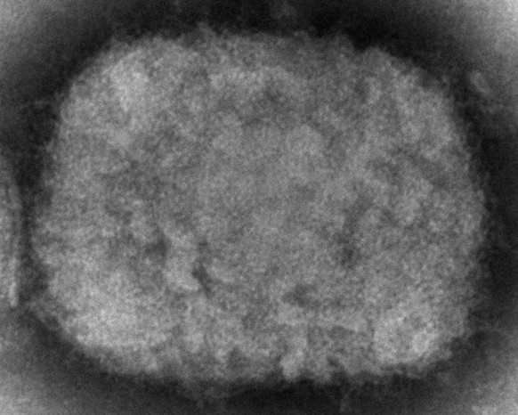 This 2003 electron microscope image made available by the Centers for Disease Control and Prevention shows a monkeypox virion, obtained from a sample associated with the 2003 prairie dog outbreak. Mon ...