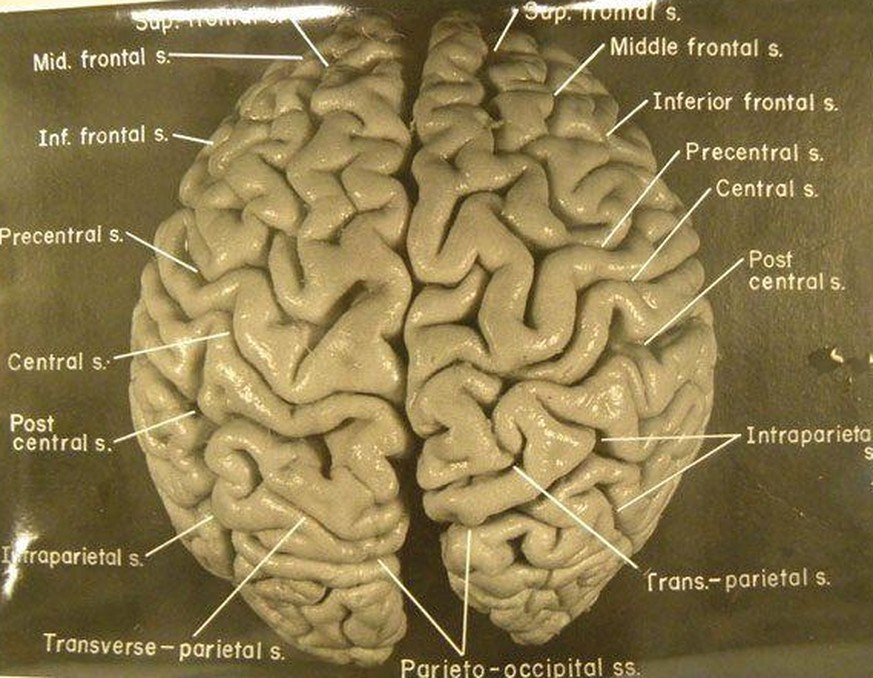 Der Pathologe, der Einsteins Gehirn stahl