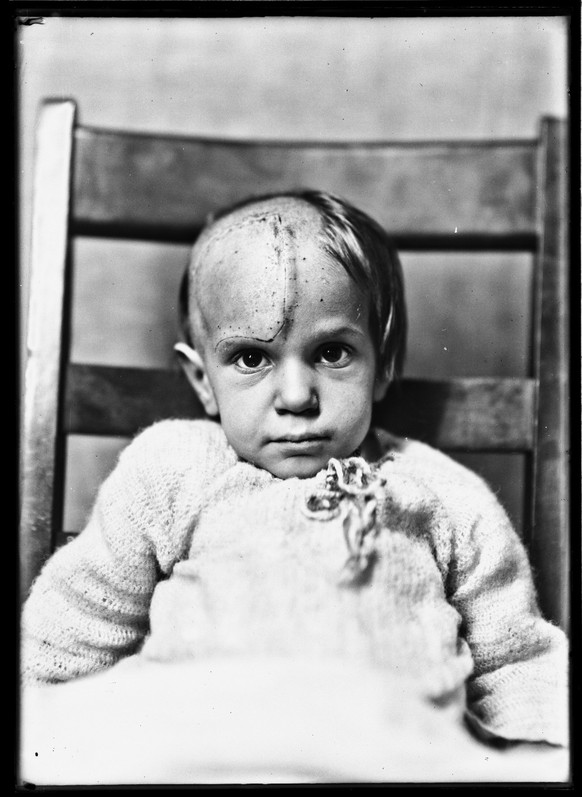 Dr. Crushing Brain Surgery

Yale University Library