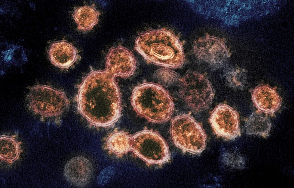 FILE - This 2020 electron microscope image provided by the National Institute of Allergy and Infectious Diseases - Rocky Mountain Laboratories shows SARS-CoV-2 virus particles which cause COVID-19, is ...