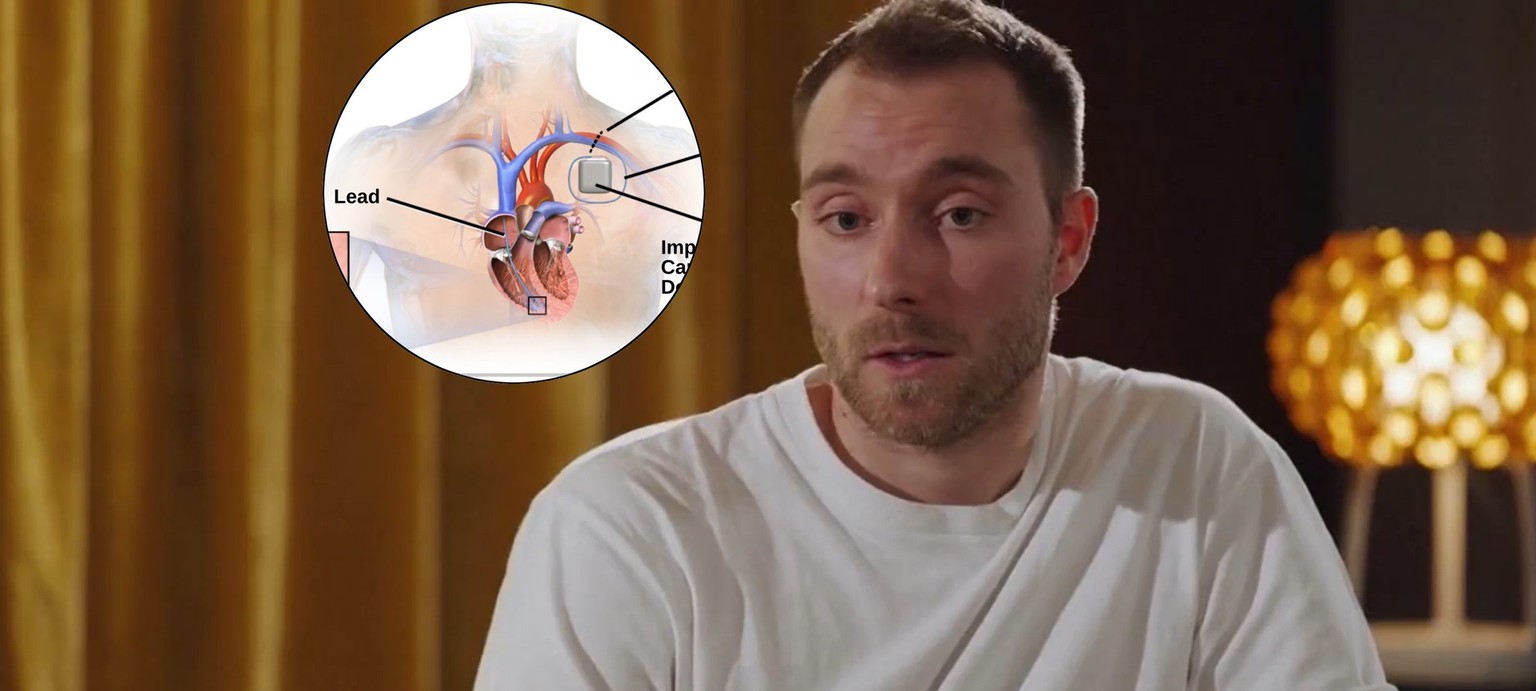 Das Ding, das nicht nur Christian Eriksen rettete