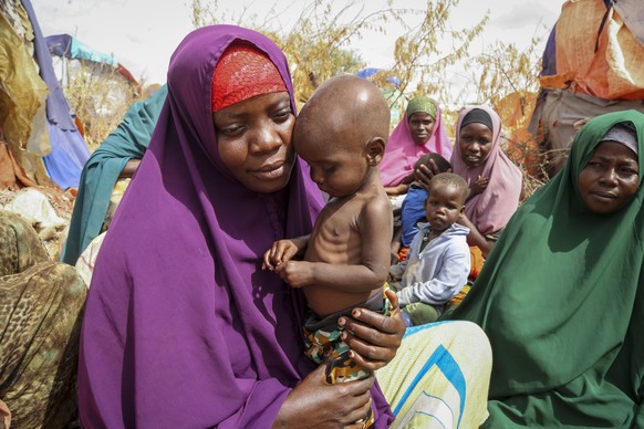 FILE - Nunay Mohamed, 25, who fled the drought-stricken Lower Shabelle area, holds her one-year old malnourished child at a makeshift camp for the displaced on the outskirts of Mogadishu, Somalia on J ...