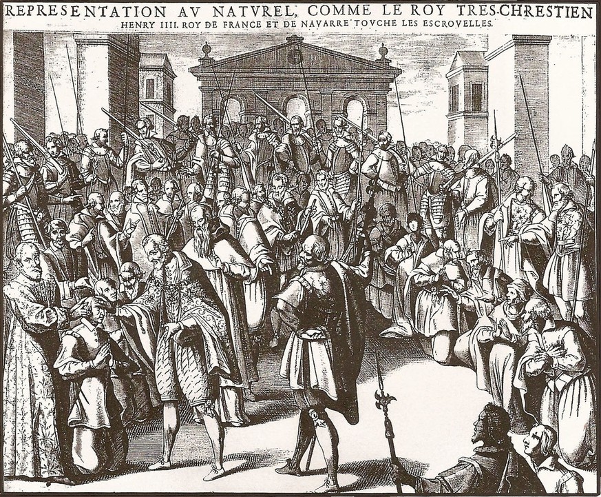 Heinrich IV. bei der traditionellen Zeremonie des königlichen „Hand­auflegens“ bei Skrofulose (Stich aus einem medizinischen Fachbuch, 1609)