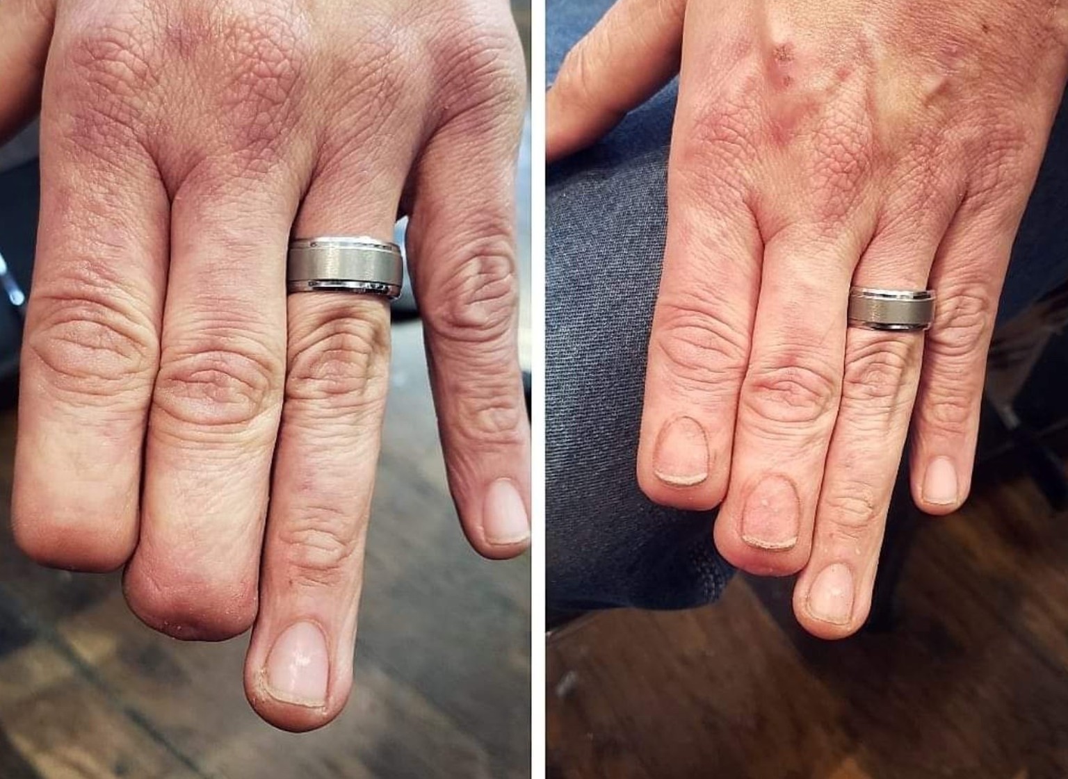 Tattoos Welche Narben Perfekt Verstecken Watson