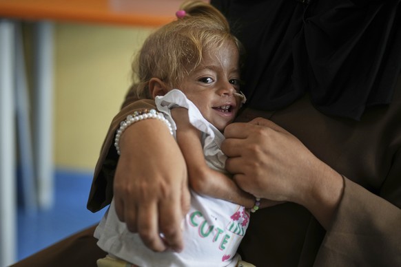 Islam Qudeih holds her daughter, Shamm Qudeih, 2, at the Santobono Pausilipon Children&#039;s Hospital in Naples, southern Italy, Tuesday, Sept. 2, 2025, where Shamm is being treated after being evacu ...