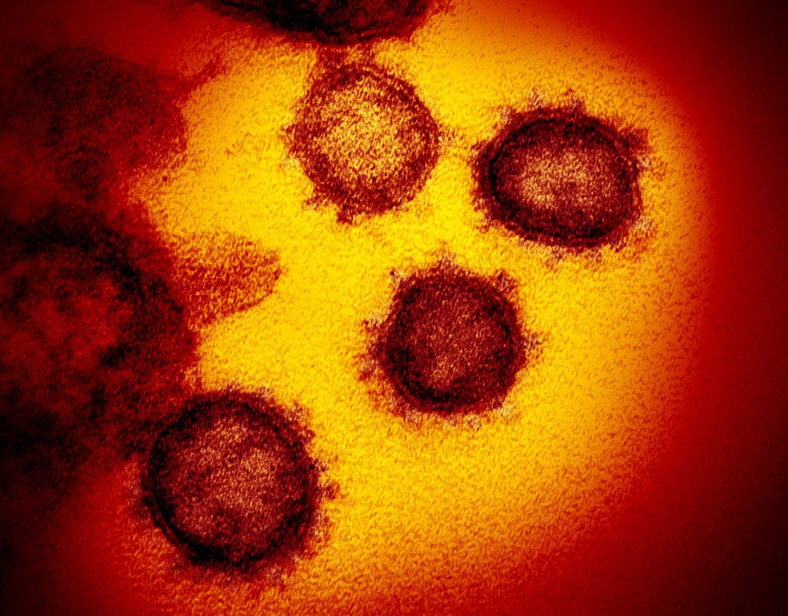 FILE - This undated electron microscope image made available by the U.S. National Institutes of Health in February 2020 shows the Novel Coronavirus SARS-CoV-2, the virus causes COVID-19. A new type of ...