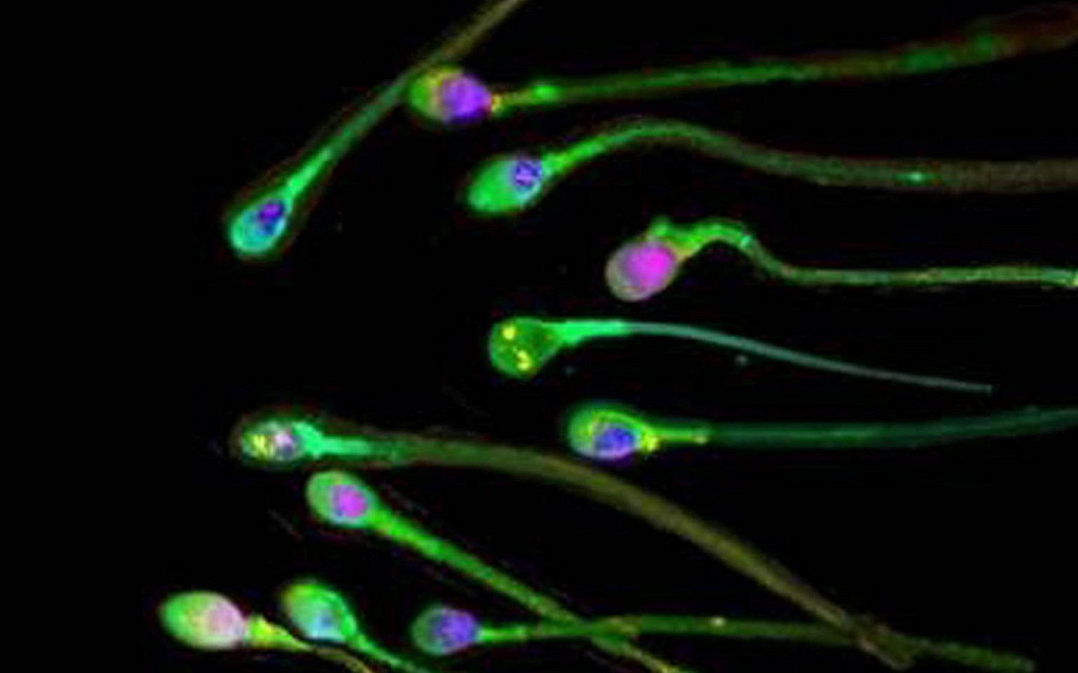 Menschliche Spermien unter dem Mikroskop.