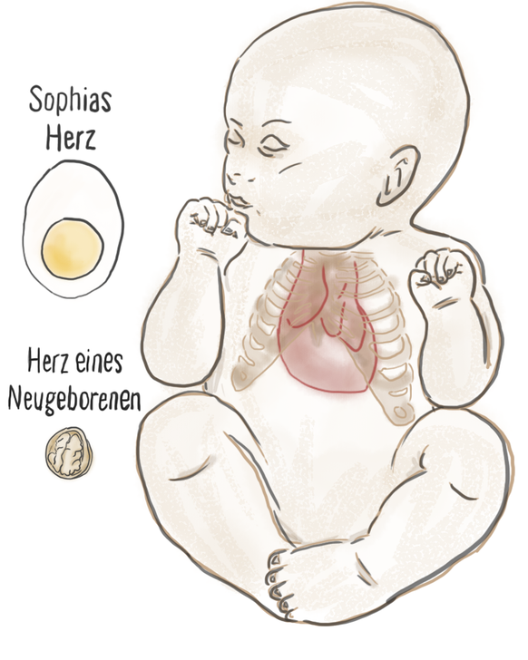 Organspende Transplantation Ralph