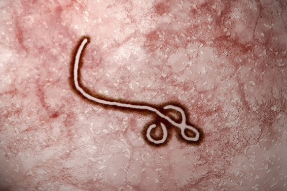 Ebola-Virus