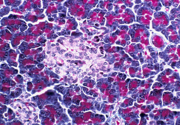 Daran wurde geforscht: Inselzellen aus dem Pankreas.