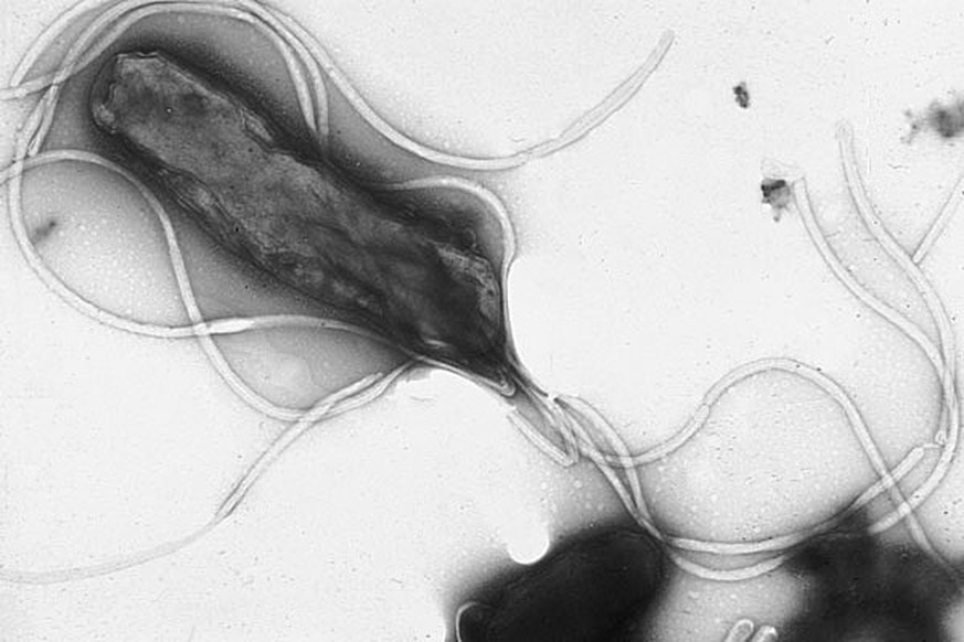 Helicobacter pylori
https://de.wikipedia.org/wiki/Helicobacter_pylori#/media/Datei:EMpylori.jpg