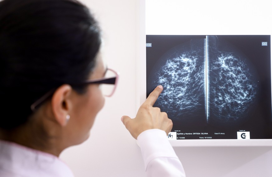 epa10268092 A doctor looks at an x-ray exam at the Comprehensive Care Center for Women in Caacupe, Paraguay, 26 October 2022. Paraguayan authorities, with Spanish support, inaugurated the ninth Compre ...