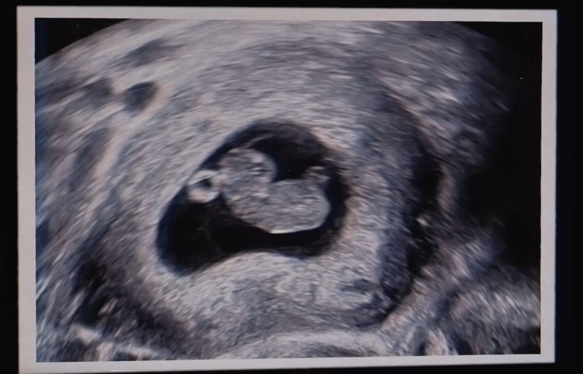 Ultraschall-Foto von Eminems schwangeren Tochter Hailie. Aus dem Musikvideo seines Songs «Temporary», 3. Oktober 2024.