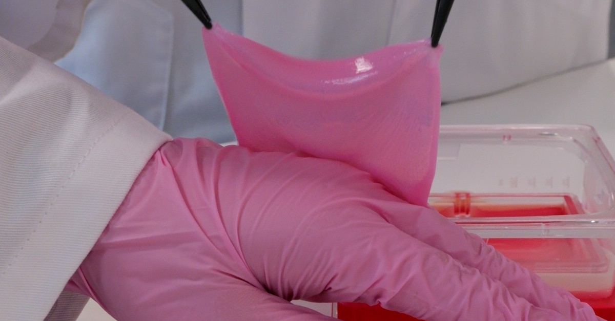 Auch für Opfer von Crans-Montana: Schweizer Firma züchtet Haut im Labor