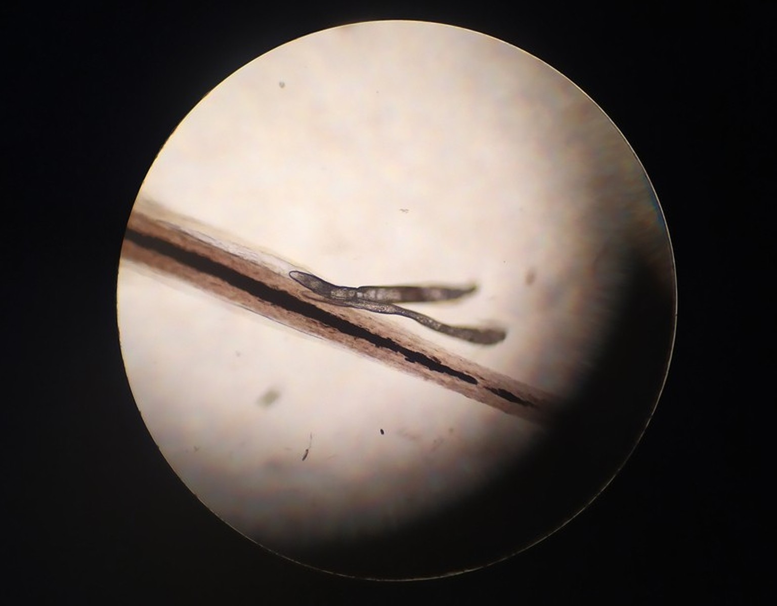 Haarbalgmilbe (Demodex folliculorum) mit Wimpernhaar.