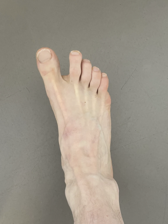 Flipflop oder nicht? das sind die schönsten Watson Füsse