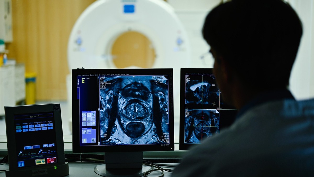 ARCHIV - 16.01.2020, Baden-W�rttemberg, Heidelberg: Ein Mitarbeiter betrachtet in einem Kontrollraum des Deutschen Krebsforschungszentrum (DKFZ) auf einem Monitor das Querschnittsbild einer Prostata.  ...