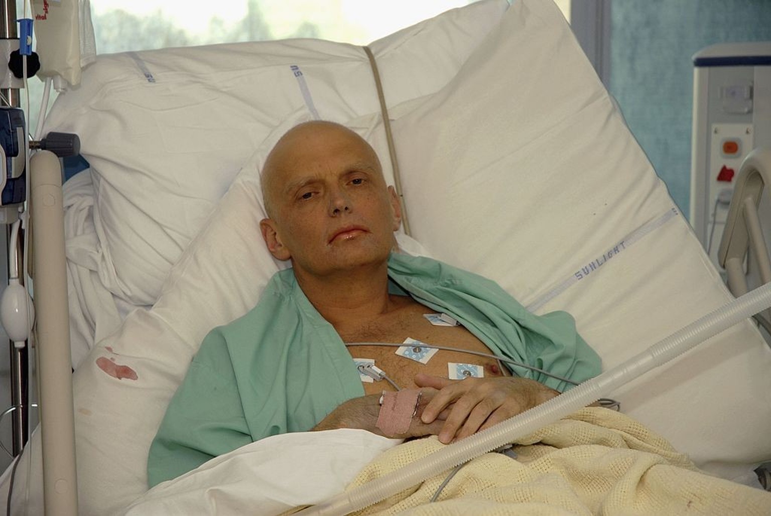 LONDON - NOVEMBER 20: In this image made available on November 25, 2006, Alexander Litvinenko is pictured at the Intensive Care Unit of University College Hospital on November 20, 2006 in London, Engl ...