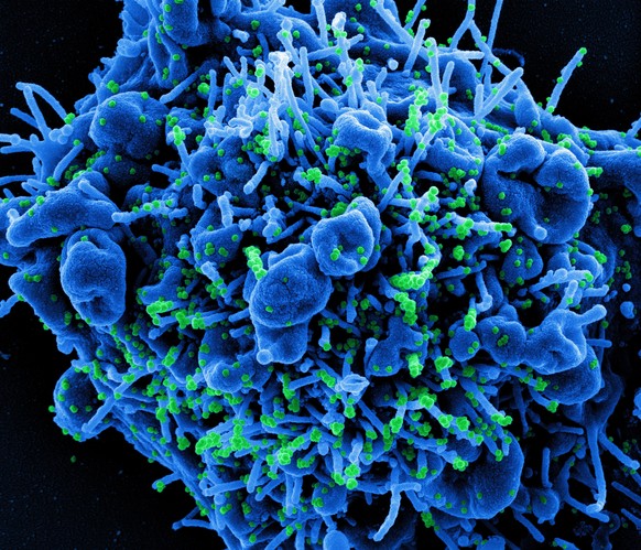 epa08966300 An undated handout image captured and color-enhanced at the National Institute of Allergy and Infectious Diseases (NIAID) Integrated Research Facility (IRF) in Fort Detrick, Maryland, USA  ...