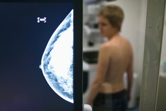 The X-ray of a woman's breast, which was just taken, appears on a screen at the Clinic Engeried in Bern, Switzerland, pictured on December 8, 2009. Mammography is a method for early detection of  ...