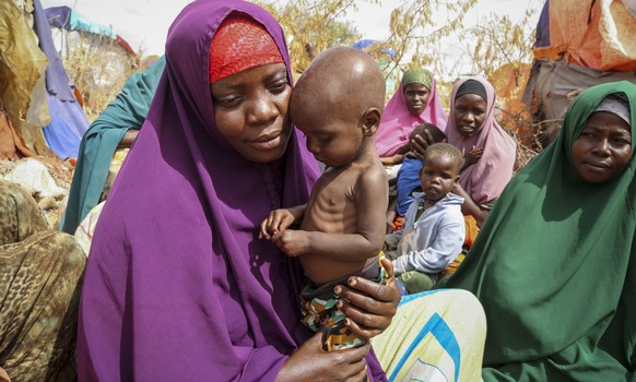 FILE - Nunay Mohamed, 25, who fled the drought-stricken Lower Shabelle area, holds her one-year old malnourished child at a makeshift camp for the displaced on the outskirts of Mogadishu, Somalia on J ...