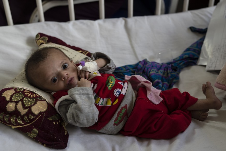 A baby boy lies on a bed as he undergoes treatment at the malnutrition ward of the Ataturk National Children's Hospital in Kabul, Afghanistan, Thursday, Dec, 2, 2021. According to U.N. figures from ea ...
