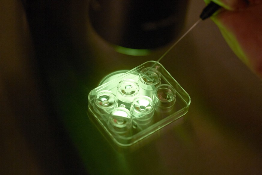 Präimplantationsdiagnostik erlaubt es dem Arzt, für die Einpflanzung ein Embryo auszuwählen, das nicht Träger einer schweren Erbkrankheit ist.