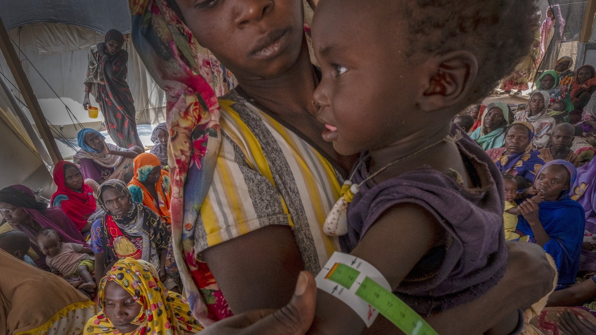epa11264106 A Sudanese refugee child receives medical treatment in the Adre transition camp, on the border with Sudan in Adre, Chad, 05 April 2024 (issued 07 April 2024). Since the war in Sudan began, ...