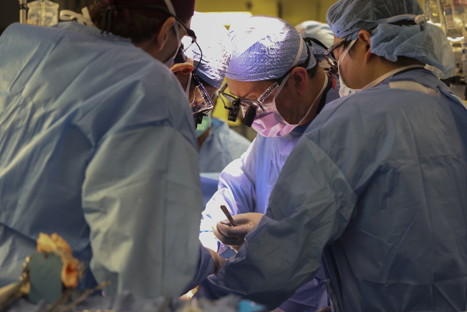 Surgeons perform the world?s first genetically modified pig kidney transplant into a living human at Massachusetts General Hospital, Saturday, March 16, 2024, in Boston, Mass. (Massachusetts General H ...