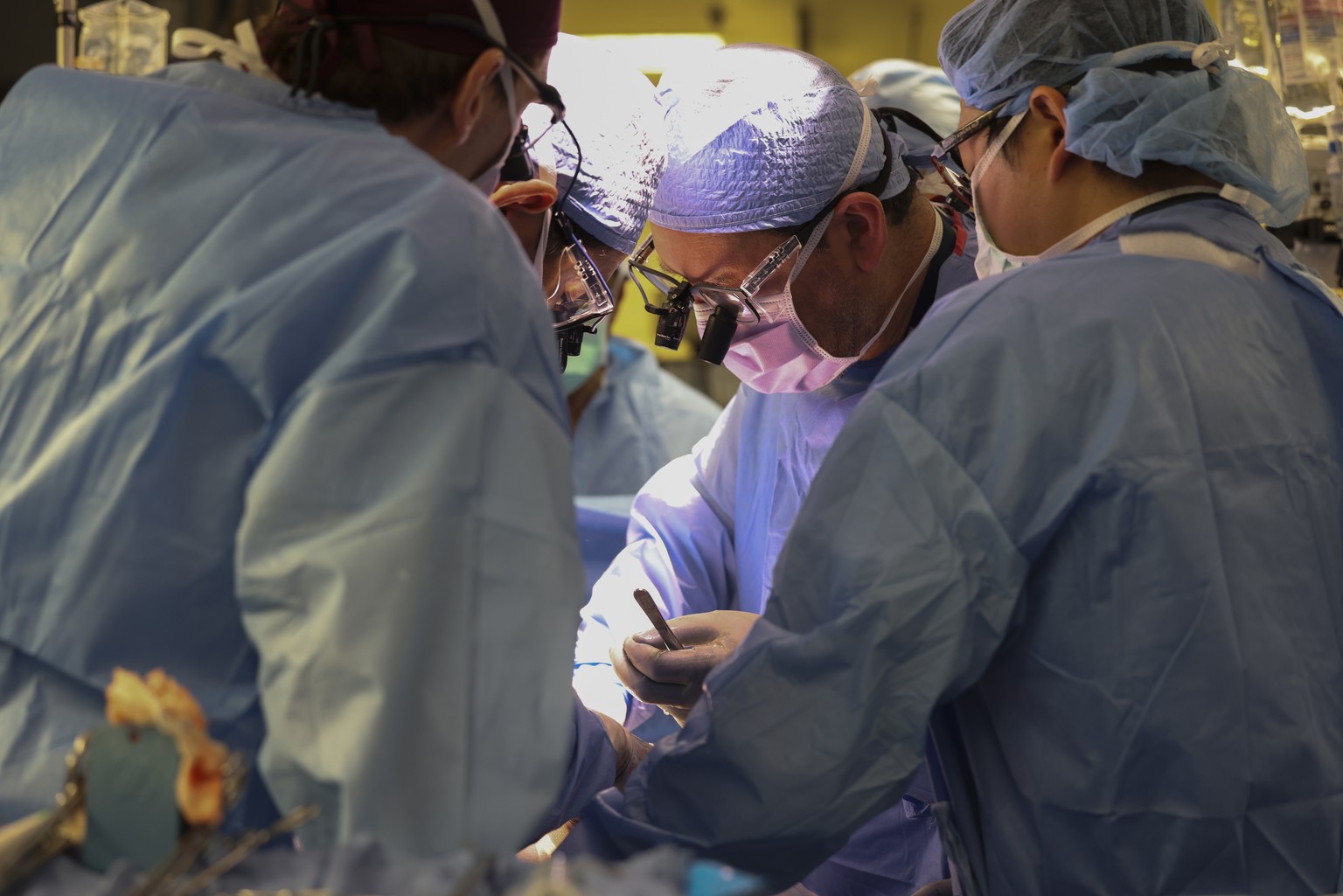 Surgeons perform the world's first genetically modified pig kidney transplant in a living human at Massachusetts General Hospital, Saturday, March 16, 2024, in Boston, Massachusetts.  (Massachusetts General H...